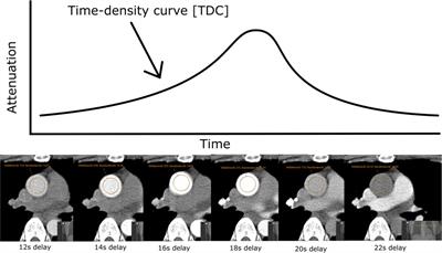 Estimating cardiac output from coronary CT angiography: an individualized compartment model in comparison to the Stewart–Hamilton method